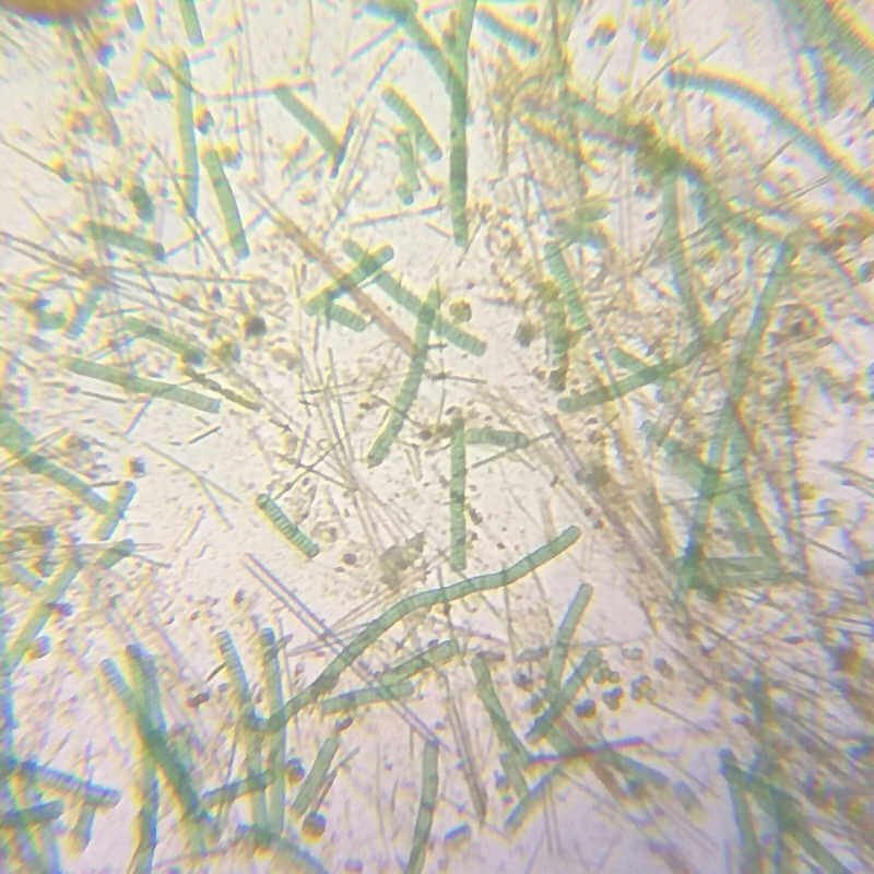 cyanobacteria microscope